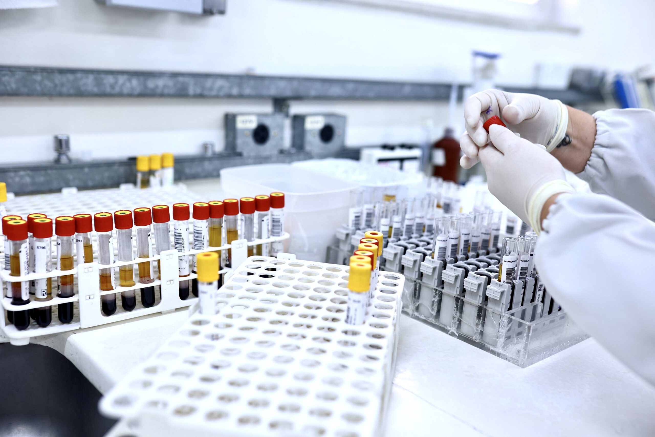 A imagem mostra um laboratório clínico com vários tubos de ensaio organizados em racks. Uma pessoa, usando luvas brancas, está a manusear um tubo de ensaio. Os tubos de ensaio são de diferentes cores, sugerindo diferentes tipos de amostras. O ambiente parece limpo e organizado, típico de um ambiente laboratorial. A imagem foca-se principalmente nos tubos de ensaio e na pessoa a manuseá-los, deixando o fundo desfocado. O foco principal é o processo de manuseio de amostras de sangue ou outro tipo de fluido biológico em um laboratório clínico.