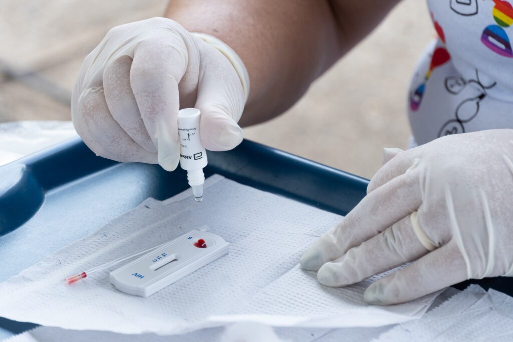 A imagem mostra uma pessoa usando luvas descartáveis realizando um teste rápido de HIV. A pessoa está segurando um frasco pequeno com um líquido, aparentemente um reagente, que será usado no teste. Uma pequena quantidade de sangue já foi colocada na cassete do teste, que está sobre uma superfície limpa e descartável. O teste em si é um dispositivo pequeno e branco com a palavra "HIV" impressa nele, indicando que é um teste para o vírus da imunodeficiência humana. O ambiente parece ser um local de atendimento médico ou uma clínica. A atenção aos detalhes da imagem sugere um procedimento médico cuidadoso e preciso.