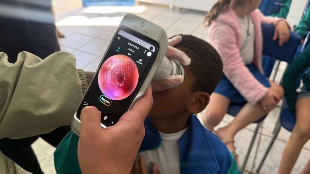 A imagem mostra um close-up de um dispositivo oftalmológico portátil sendo usado para examinar o olho de uma criança. O dispositivo, que parece ser um oftalmoscópio digital, está sendo segurado por uma pessoa com luvas. A tela do dispositivo exibe uma imagem ampliada do interior do olho, com detalhes como vasos sanguíneos e a retina visíveis. Ao fundo, outras crianças estão sentadas, possivelmente em uma sala de aula ou clínica, aguardando seus exames. Uma das crianças ao fundo usa um cardigã rosa e uma saia azul, enquanto outra usa uma jaqueta azul. O ambiente parece ser iluminado e informal, sugerindo um programa de rastreio ocular ou uma demonstração educacional. O foco principal da imagem é a tecnologia sendo usada para a saúde ocular pediátrica.