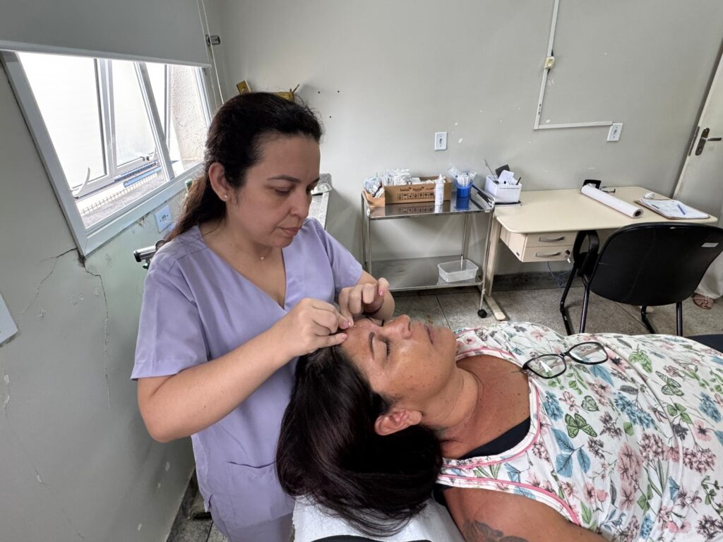 A imagem mostra uma profissional de saúde em um consultório, realizando um procedimento estético em uma paciente. A profissional, vestindo um uniforme lilás, está inclinada sobre a paciente, que está deitada em uma maca. Com pinças finas, a profissional parece estar aplicando ou removendo algo da testa da paciente, possivelmente fios de sutura ou aplicando algum tipo de tratamento na pele. O ambiente sugere um local de atendimento médico ou estético, com uma janela ao fundo, uma mesa com materiais médicos e uma cadeira. Há também uma bandeja metálica com caixas de materiais descartáveis e recipientes. A paciente está relaxada, com os olhos fechados, e usa uma blusa estampada com flores e borboletas. Óculos de grau estão sobre o peito da paciente. A iluminação é clara, vindo principalmente da janela e de fontes de luz internas.