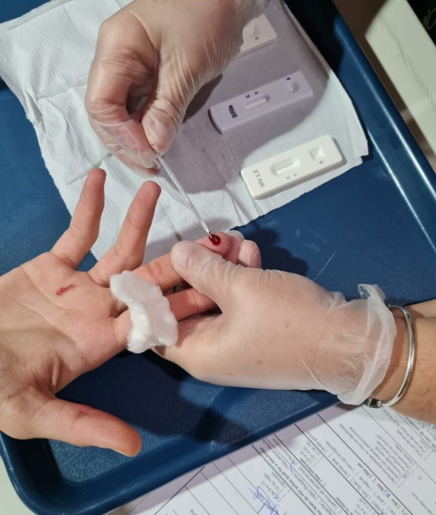 A imagem mostra um close-up de um teste rápido de HIV sendo realizado. Uma pessoa, usando luvas descartáveis, está coletando uma gota de sangue do dedo de outra pessoa com um conta-gotas. Ao lado, sobre uma toalha de papel branca, estão dois kits de teste rápido, um rotulado "Sifis" e outro "HIV 1.2". Há também uma bola de algodão para estancar o sangue no dedo. Ao fundo, um formulário com algumas anotações e campos para preenchimento pode ser parcialmente visto. O ambiente parece ser clínico ou de saúde.