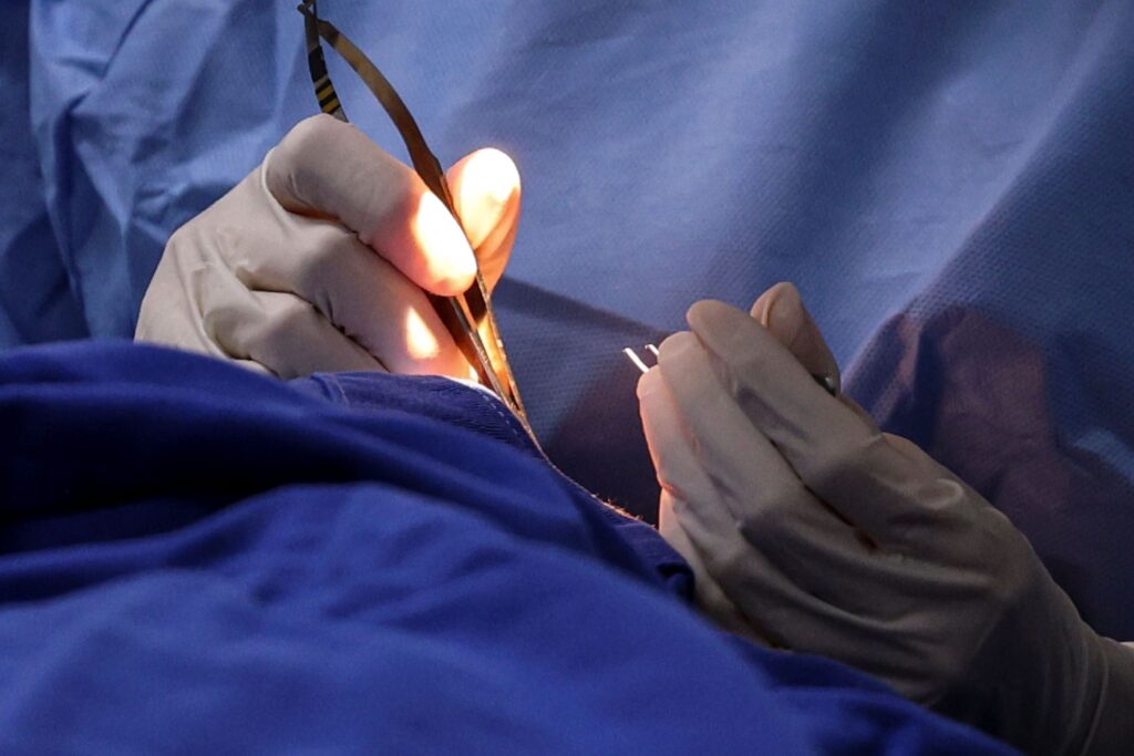 A imagem mostra um close-up de um procedimento cirúrgico em andamento. Duas mãos enluvadas, com luvas brancas, estão manipulando instrumentos cirúrgicos sobre um campo operatório coberto por um tecido azul, típico de ambientes hospitalares. A mão esquerda segura um instrumento metálico, possivelmente uma pinça ou porta-agulha, enquanto a mão direita segura um instrumento menor, que pode ser uma agulha ou um gancho cirúrgico. A iluminação é forte e focada, destacando a delicadeza e a precisão do trabalho realizado. O fundo azul do tecido cirúrgico cria contraste com as luvas brancas e os instrumentos metálicos, enfatizando o ambiente estéril e controlado da cirurgia. A imagem transmite um momento de concentração e cuidado durante um procedimento médico.