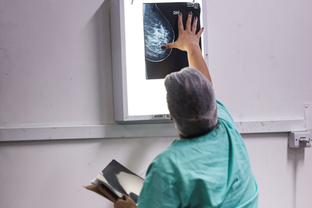 A imagem mostra uma profissional da área da saúde, provavelmente uma radiologista ou técnica, analisando uma mamografia. Ela está de costas e um pouco de lado, vestindo um uniforme cirúrgico verde e uma touca cinza. Com a mão direita, que tem as unhas pintadas de vermelho escuro, ela está tocando uma lâmpada de luz onde está exibida a mamografia de uma mama, que apresenta áreas de tecido denso e algumas regiões brancas que podem indicar anormalidades. Na mão esquerda, ela segura um conjunto de outros exames ou documentos médicos. O ambiente é clínico, com uma parede branca ao fundo e uma tomada visível ao lado direito. A iluminação está focada na lâmpada de luz, destacando o exame que está sendo analisado. A imagem transmite a seriedade e a atenção dedicadas à análise de exames médicos.
