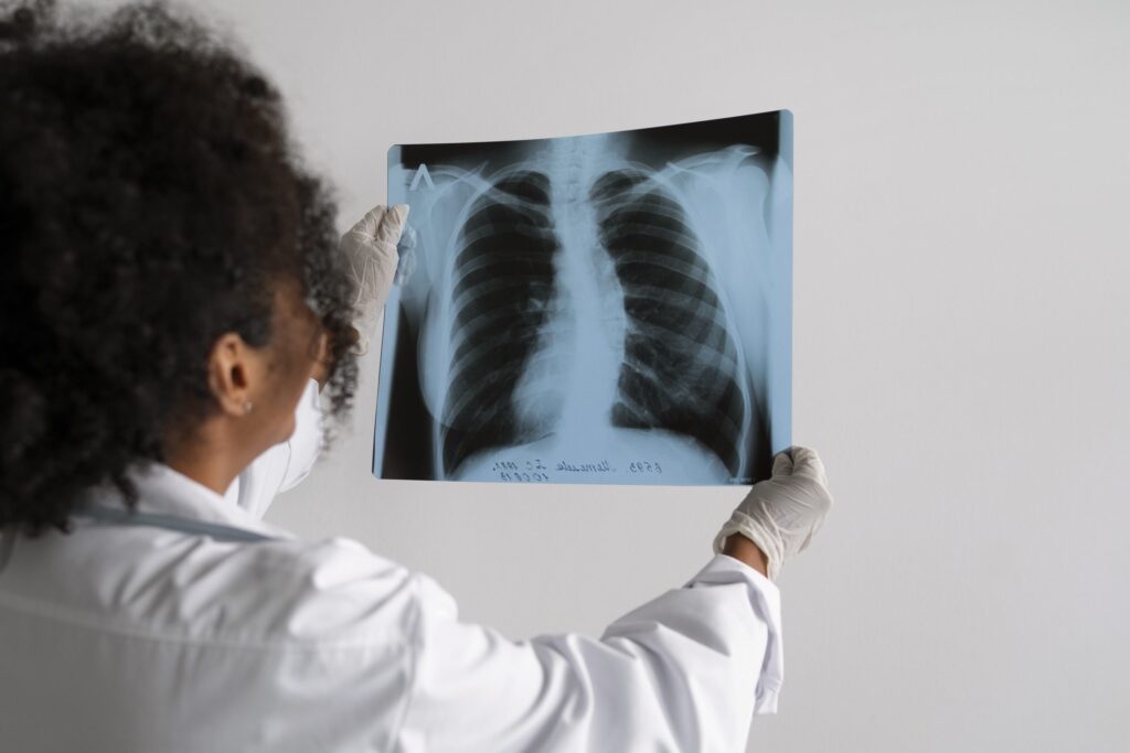 A imagem mostra uma profissional de saúde, vista de perfil e de costas, vestindo uma bata branca e luvas de proteção médicas. Ela segura com ambas as mãos uma radiografia do tórax contra a luz para a examinar.